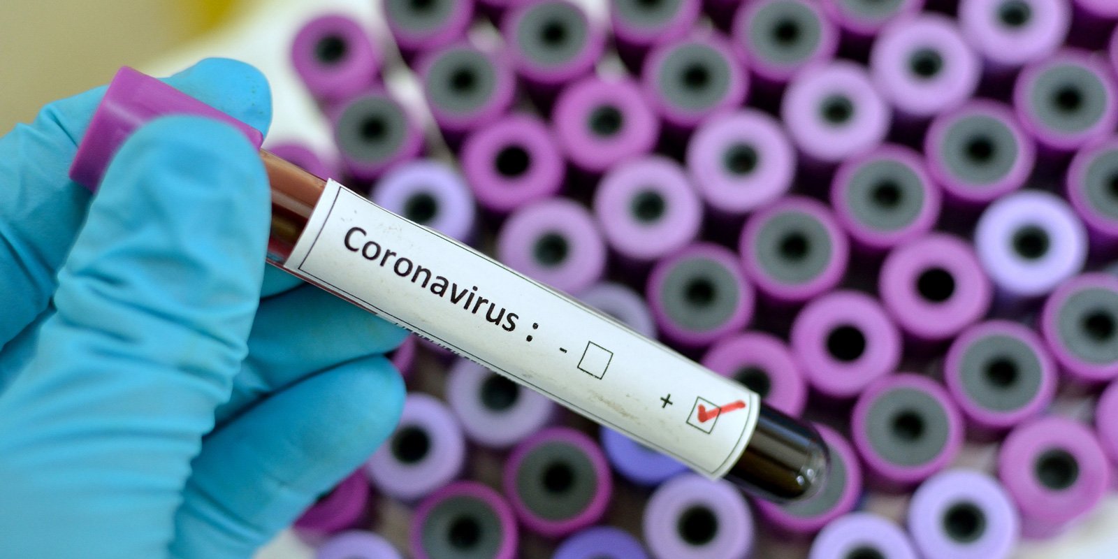 Coronavirus